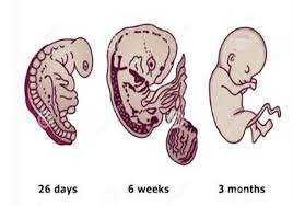 做泰国试管婴儿怀上了，但医生为什么告诉我没有胎心？