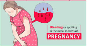 泰国试管婴儿后孕早期出血的常见原因